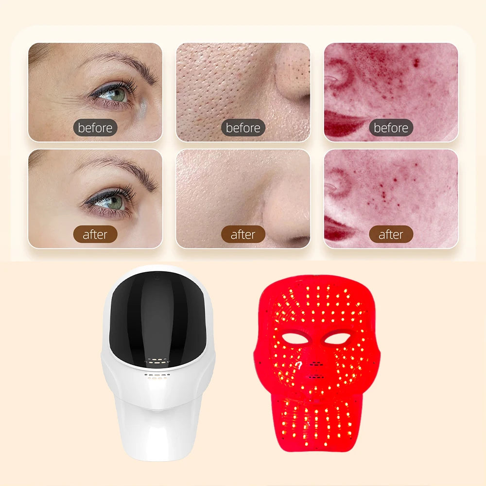 Celestia Beauty™ 7 Colors Led Facial Mask With Neck